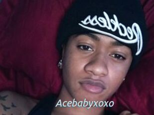 Acebabyxoxo