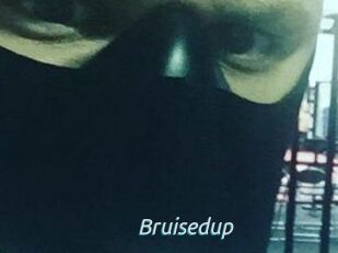 Bruisedup